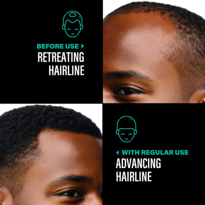 100% Unrefined Batana Oil 4 Oz